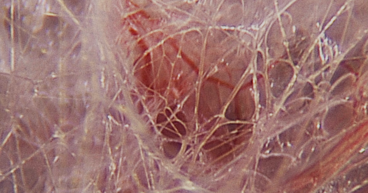 Fascie: het bindweefsel dat je hele lichaam verbindt